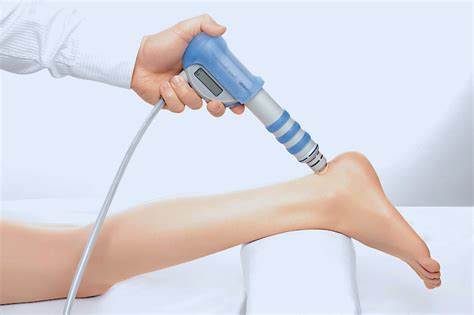 radial shockwave therapy for itb